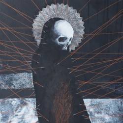 Lumbar : The First and Last Days of Unwelcome